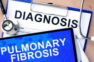 Elder Care in Skokie IL: FAQS About Pulmonary Fibrosis