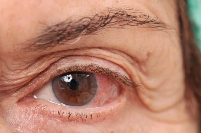 Personal care services support seniors in protecting vision and eye health